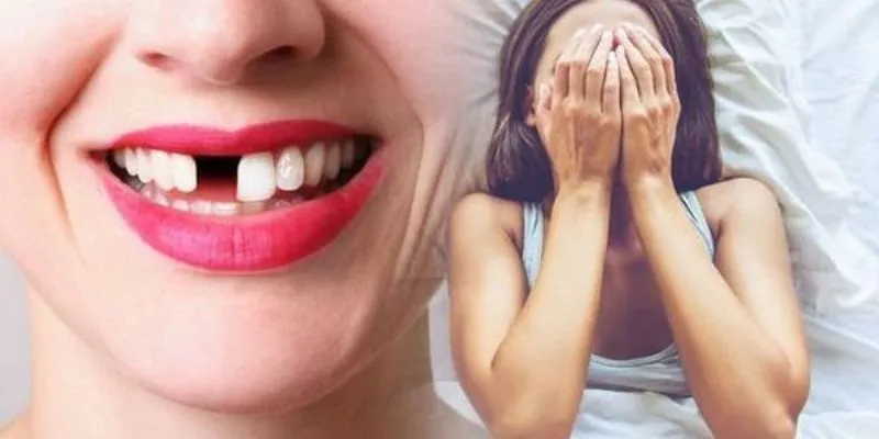 Tổng hợp các trường hợp nằm mơ rụng răng 