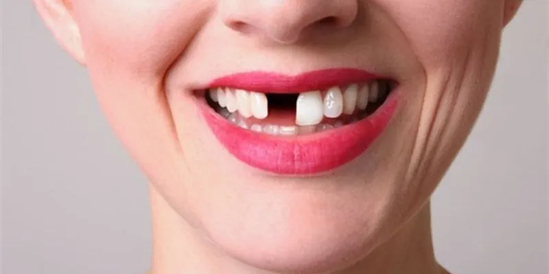 Tổng hợp những con số liên quan đến giấc mơ rụng răng